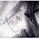 xtobi
