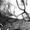 AntonLee