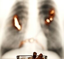 Smoking WILL kill you by Jenella