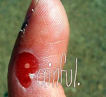 Painful by Craig Medeiros