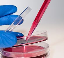 Cell cultures in Petri dishes by PhotoStock-Isra