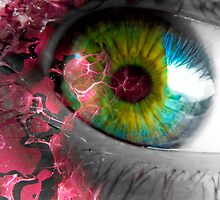pink eye by doesremindme