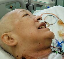 Cancer Surgery (10)、OSAKA JAPAN by yoshiaki nagashima
